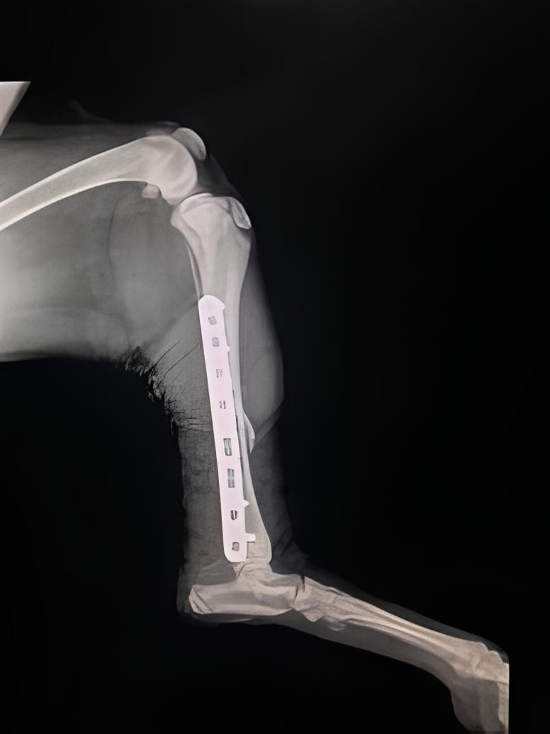 um RX de uma fratura de tíbia.